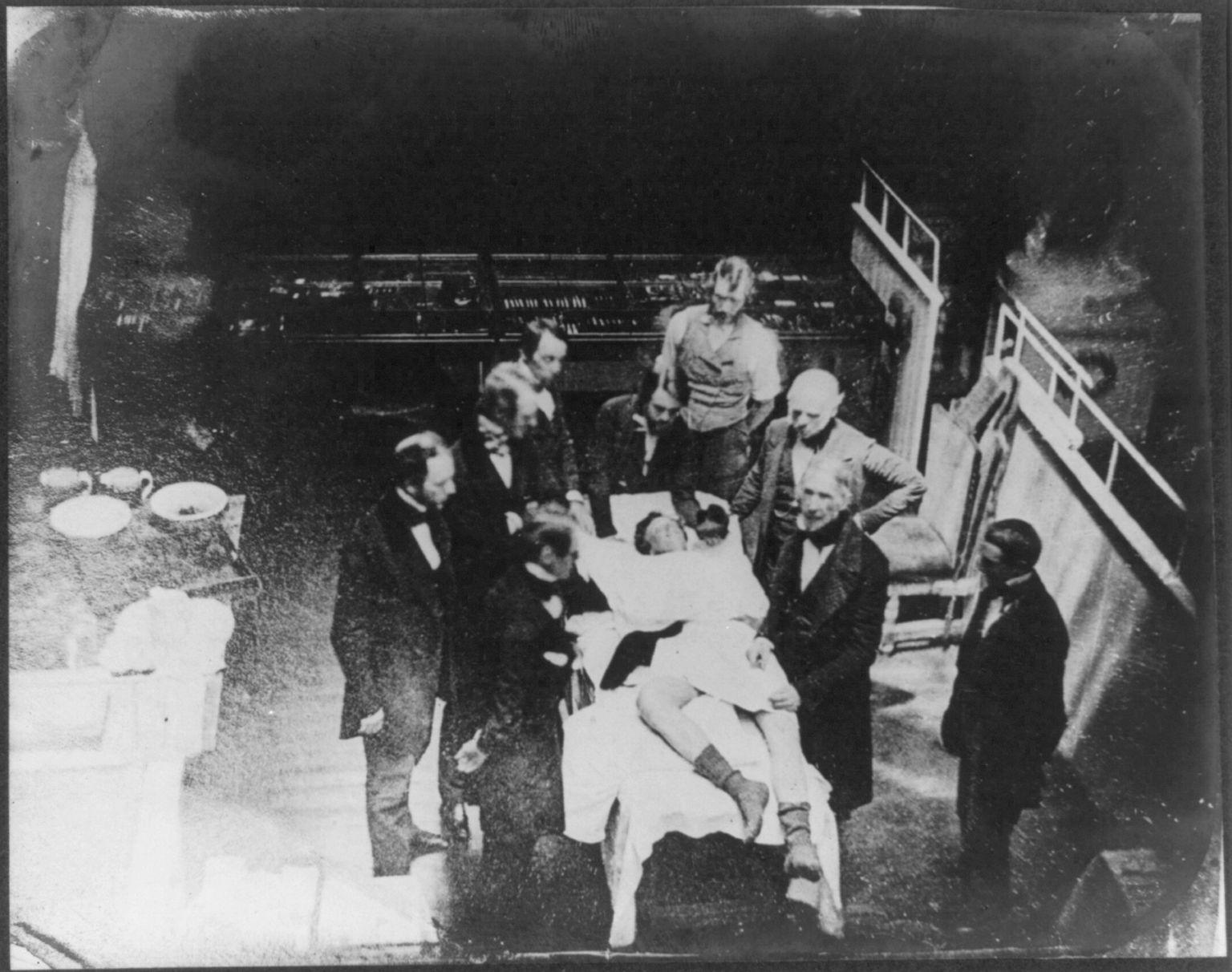 An old photograph looking down on a group of men in dark frock coats standing around a patient laid on an operating chair, his bare leg extended, with a raised gallery rail on the right.